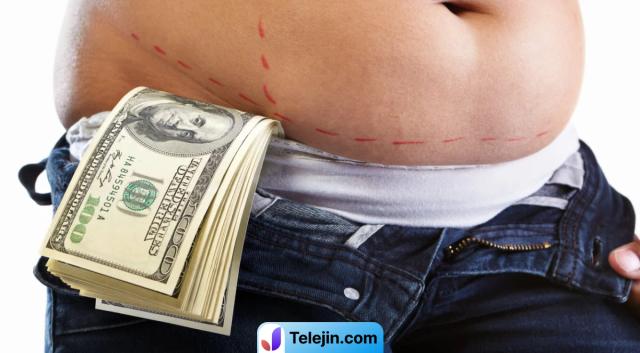 هزینه انجام اسلیو معده